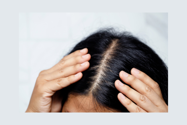 how to take care of scalp